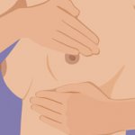 Вернуть прежнюю форму груди без операции 